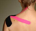 Kinesio taping