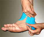 Kinesio taping